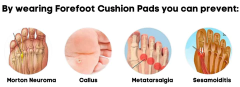 BROWSLUV™ Forefoot Cushion Pads 2.0