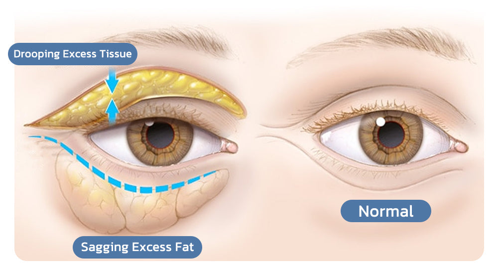 OPENEYES Awaken Peptide Lifting Eye Gel - Buy 1 Get 1 FREE