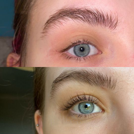 BROWSLUV™ Eyelash Active Serum For Longer & Fuller Lashes