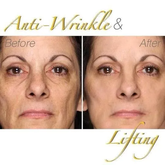 BROWSLUV™ Youth 24K Gold Peel-Off Mask - Buy 1 Get 1 Free