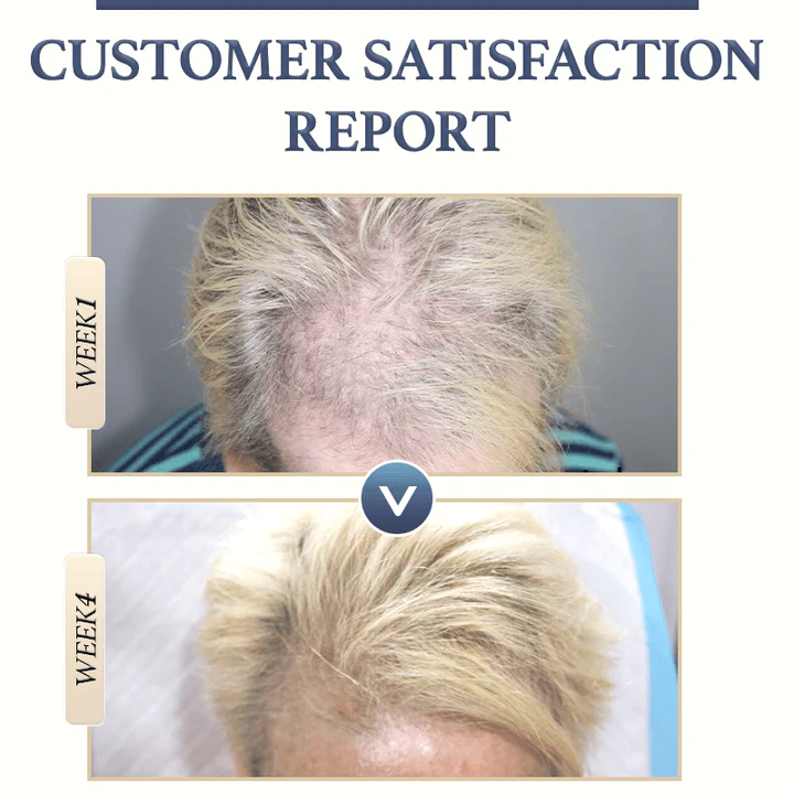 BROWSLUV™ Anti-Hair Loss Rice Shampoo Bar | Buy 1 Get 1 FREE