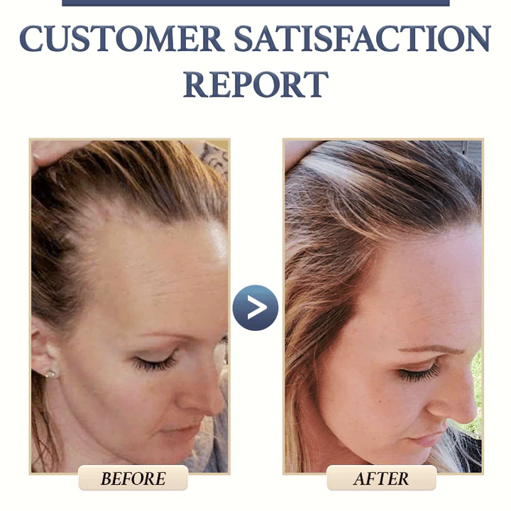 BROWSLUV™ Anti-Hair Loss Rice Shampoo Bar | Buy 1 Get 1 FREE