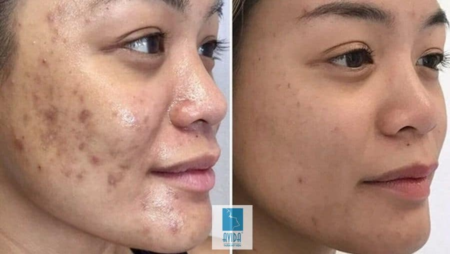 BROWSLUV™ SKIN WHITENING EXFOLIATING GEL | Buy 1 Get 1 Free