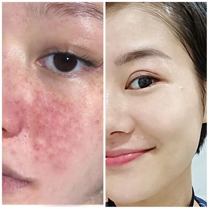BROWSLUV™ SKIN WHITENING EXFOLIATING GEL | Buy 1 Get 1 Free