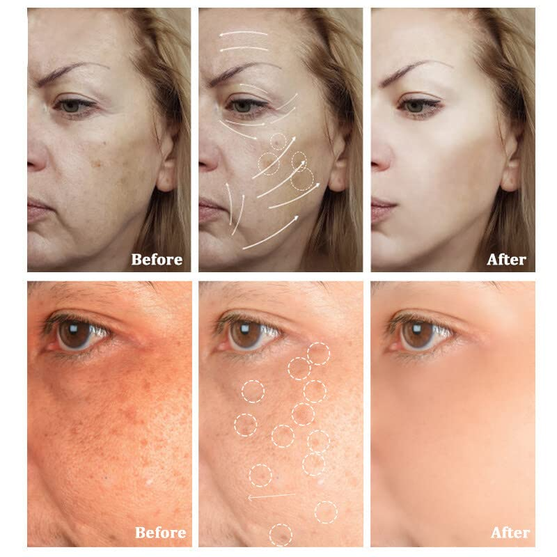 BROWSLUV™ Korean Collagen Firming Mask