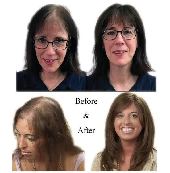 BROWSLUV™ Natural Human Hair Clip 150% Density | Solve the problem of hair loss!