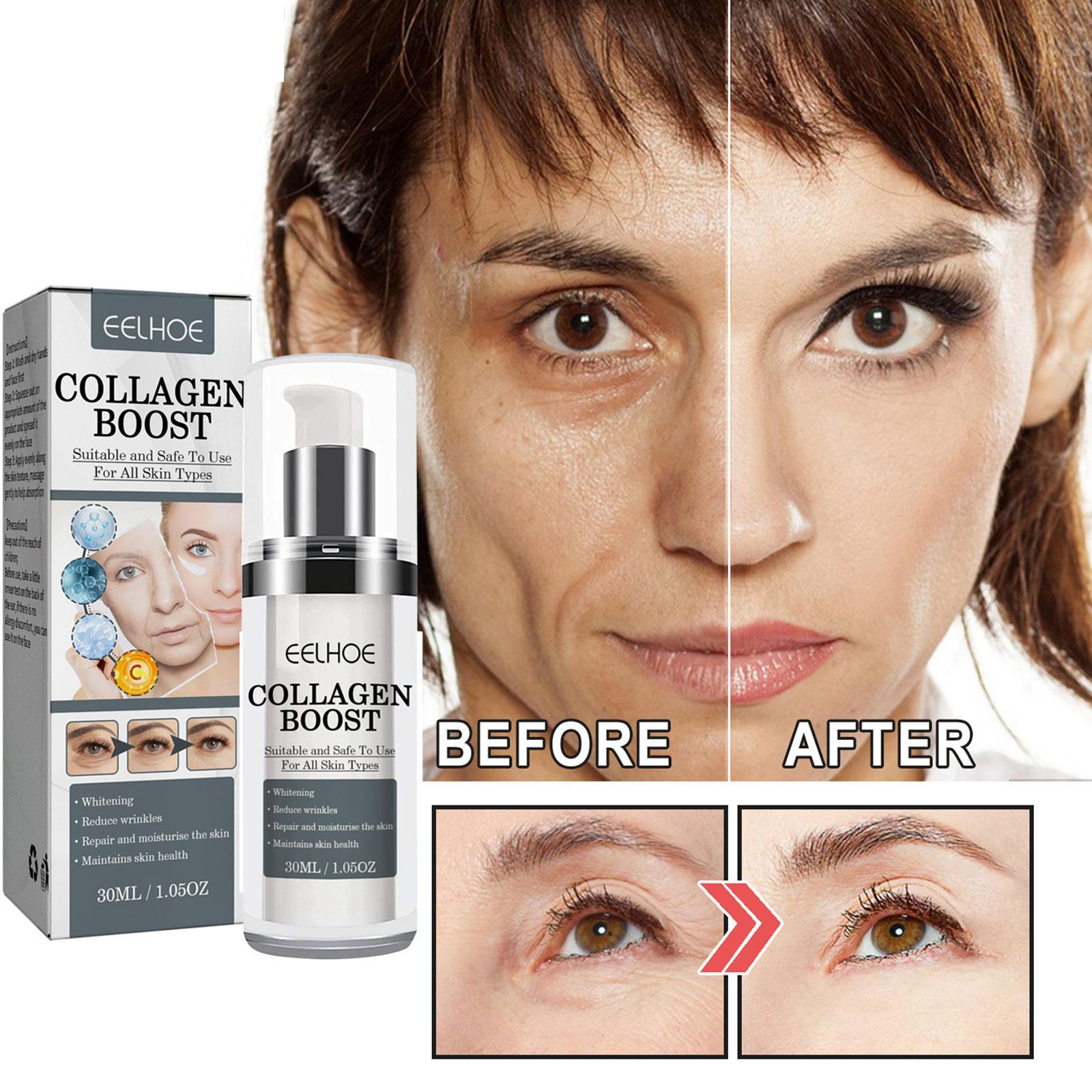 Collagen Boost™ Anti Wrinkle Cream